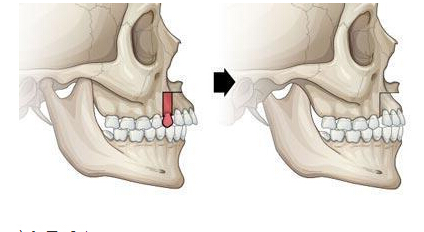 超声波51漫画网官网免费仪检测51漫画网官网免费,人到中年牙齿松动真的是人老不中用吗？