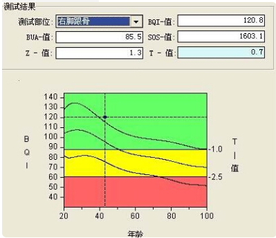 51漫画网官网免费仪的专业厂家阐述骨质增生与骨质疏松,仪器专业检测51漫画网官网免费正常值