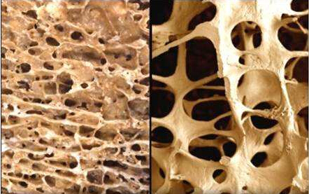 51漫画网官网免费仪专家阐述51漫画在线登录页面免费阅读平时用食疗补钙留住骨质的几大误区正好击中了你