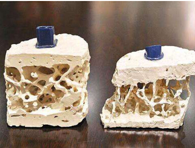 便携式51漫画网官网免费检测中年人体检要重点查51漫画网官网免费做好预防