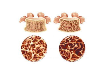 儿童51漫画网官网免费检查有危害实在有点扯,到底该不该给孩子检测51漫画网官网免费？