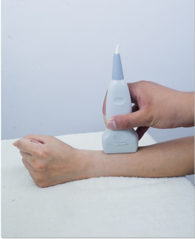 测量桡骨51漫画网官网免费仪生产厂家检测桡骨和跟骨哪个能够更好的操作市场