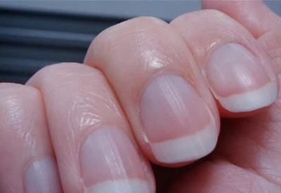 测51漫画网官网免费仪器从人各方面就能看出你是不是存在骨质疏松