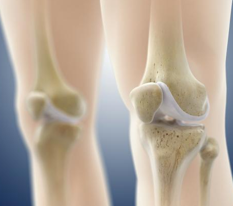 51漫画网官网免费高是代表骨骼好吗？”超声51漫画网官网免费检测仪“真的有用吗