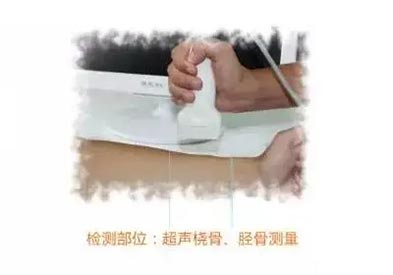 手提式超声儿童51漫画网官网免费仪mqd-7000品牌测桡胫骨部位原理及适用范围