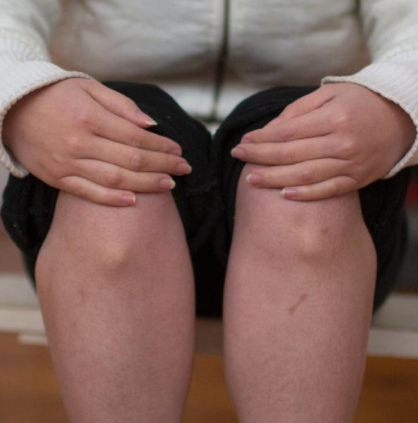 儿童51漫画网官网免费检测仪厂家属于什么设备要真怎么查你想了解的问题听听医生怎么说