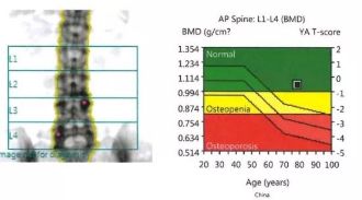 超声51漫画网官网免费分析仪品牌检测数据怎么看详情？测量结果怎么看